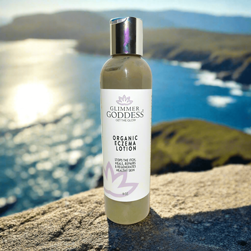 Organic Eczema Lotion – Soothing Relief & Skin Healing