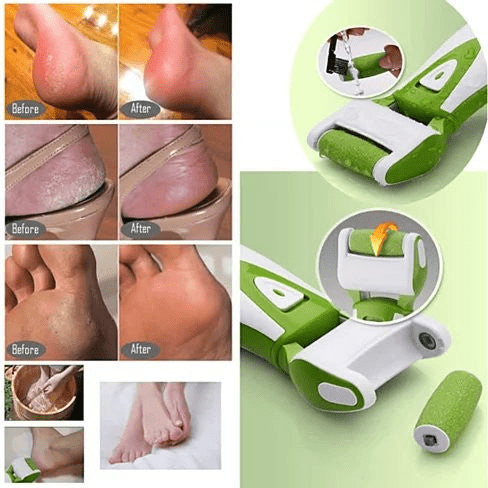 Roll On Sole Foot Spa - All-Natural Quartz Callus Remover & At-Home Pedicure Tool