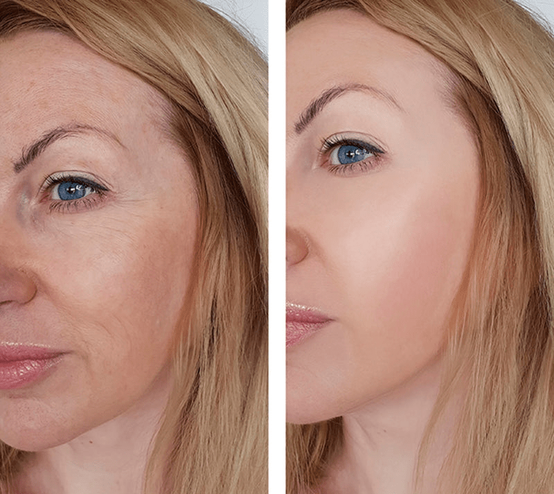💎 The Complete Fix Youth Serum – Clinical Anti-Aging with Powerful Botanicals